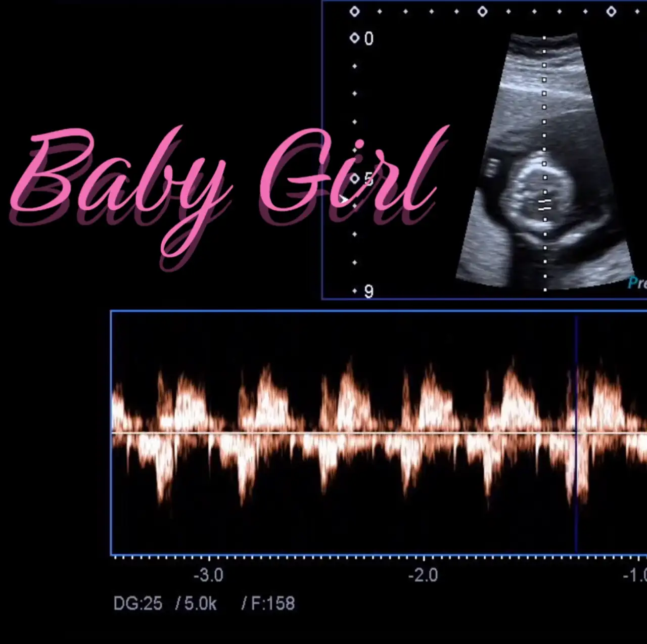 Baby Girl Image